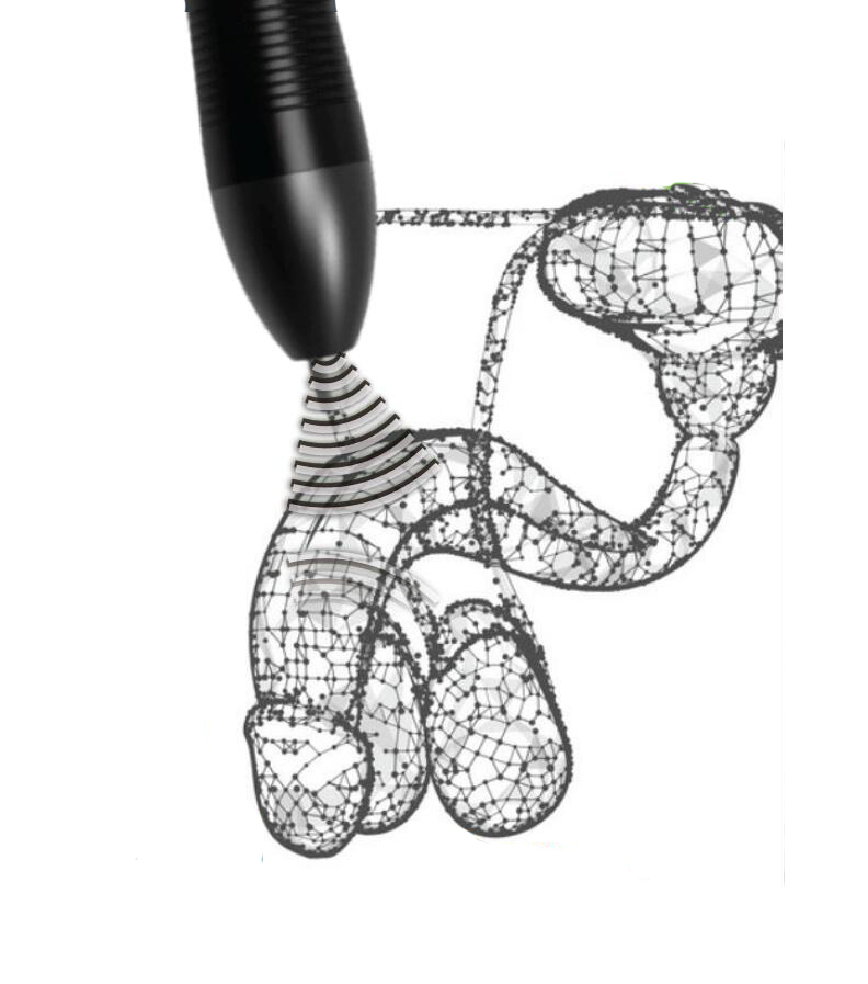 Erectile Dysfunction treatment device TOPMED ED home remedy